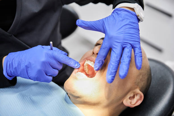 Best Emergency Dental Services for Seniors in El Monte, CA
